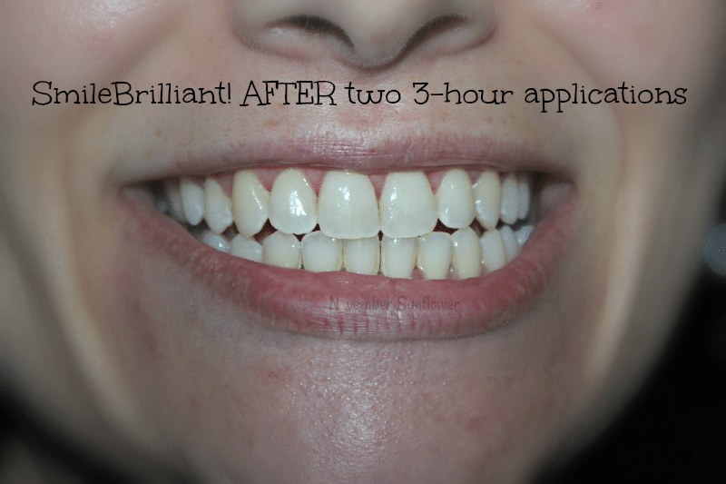 teeth whitening journey #smilebrilliant #sponsored