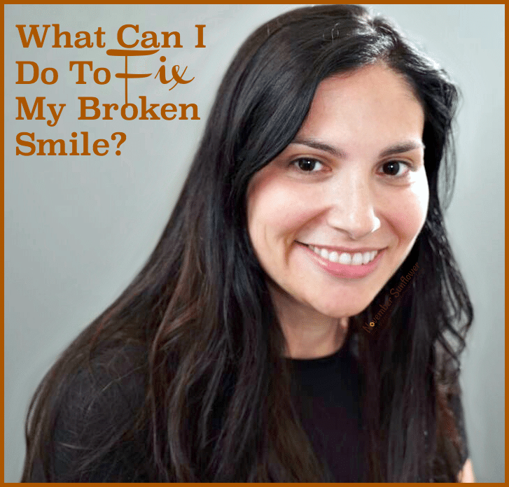 What can one do to fix a broken smile? 