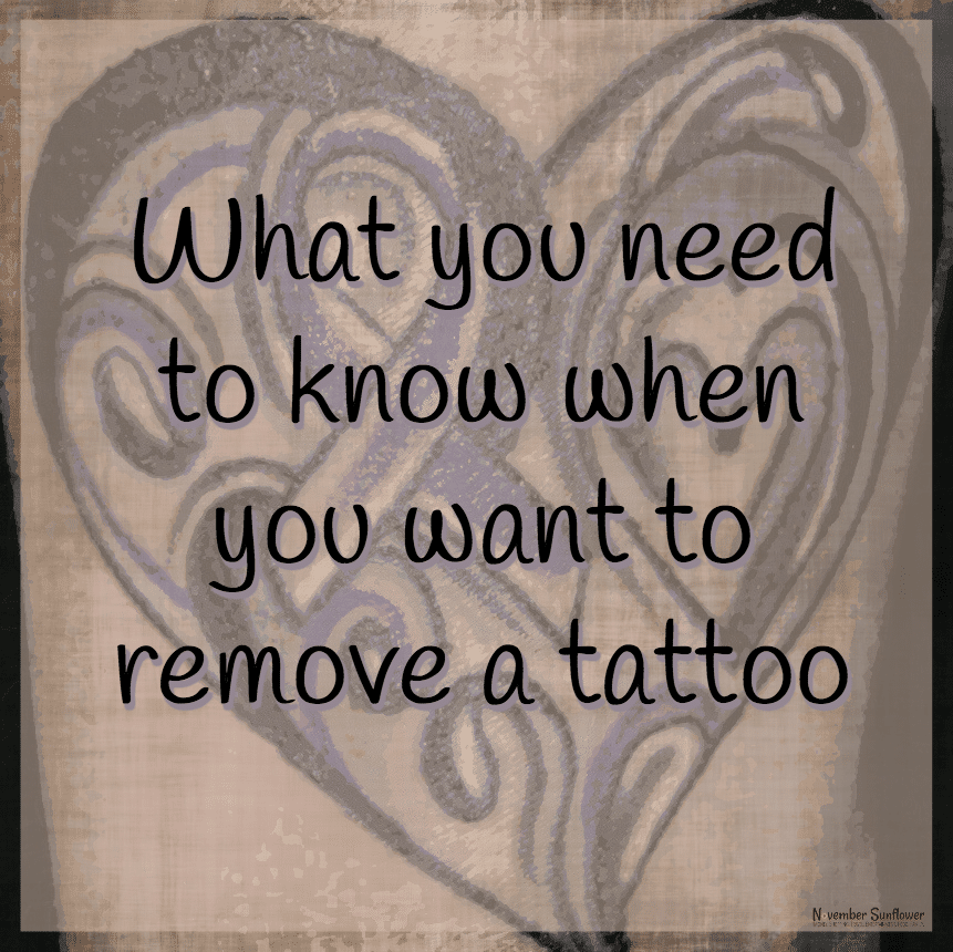 What you need to know when you want to remove a tattoo 