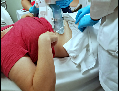 Freeze stubborn fat cells & contour your body with CoolSculpting